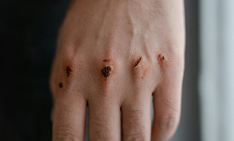 sensitive skin safety tips